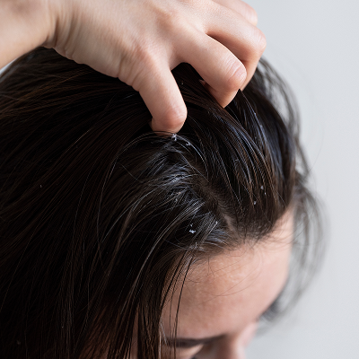 Sensitive scalps needing clean formulas